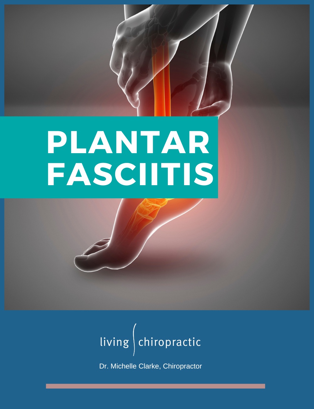 Plantar Fasciitis Living Chiropractic